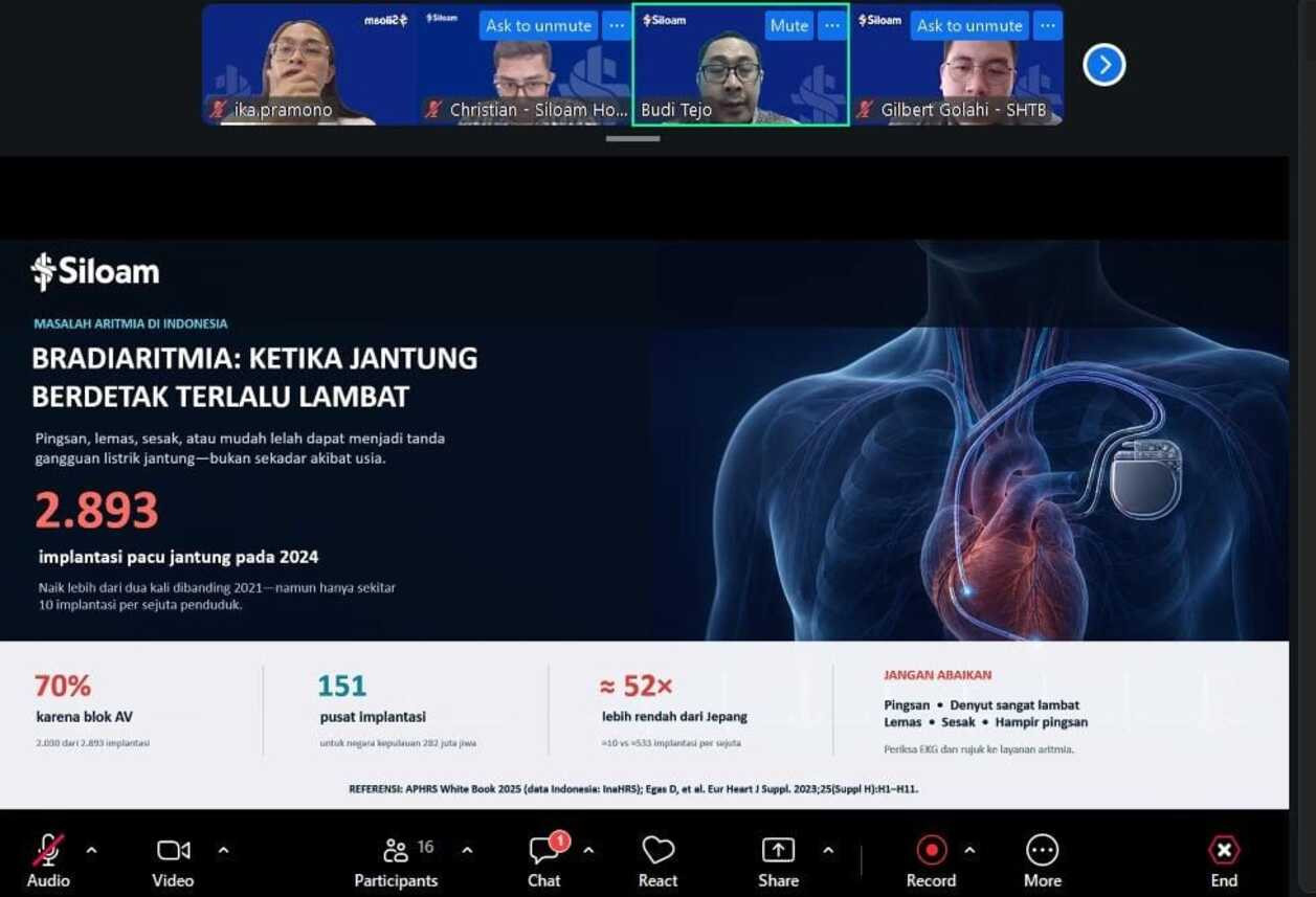Pacemaker Tanpa Kabel jadi Pilihan Baru bagi Pasien Aritmia