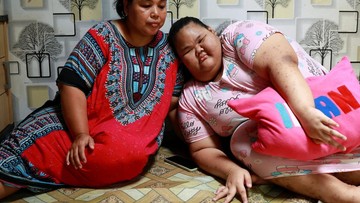 Remaja Obesitas di Bogor Terpaksa Putus Sekolah Usai Menjadi Korban Bullying